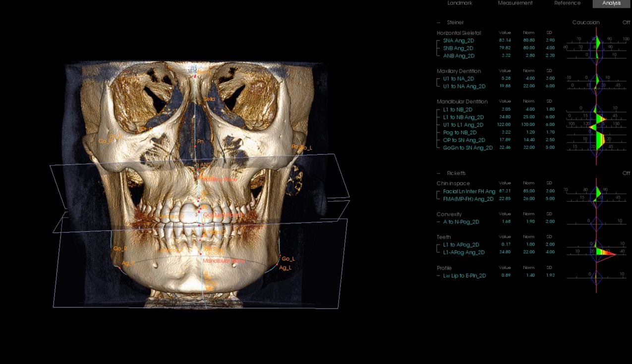 Our i-CAT® Cone Beam 3D Dental Imaging
