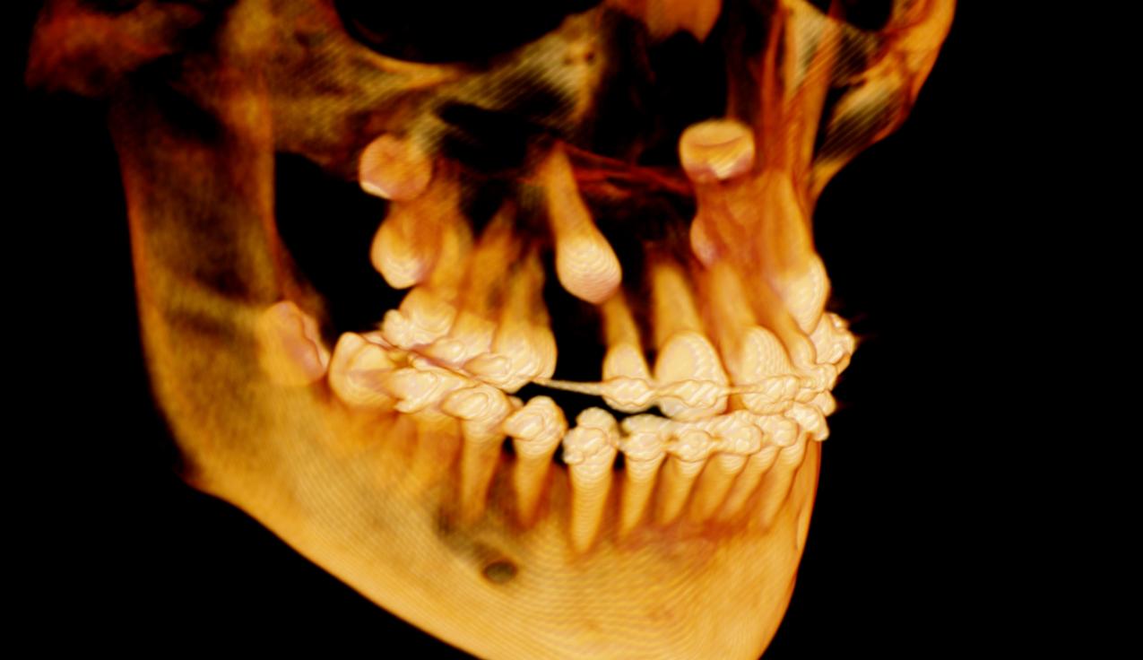 Our i-CAT® Cone Beam 3D Dental Imaging